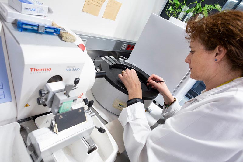 Inmunohistoquímica